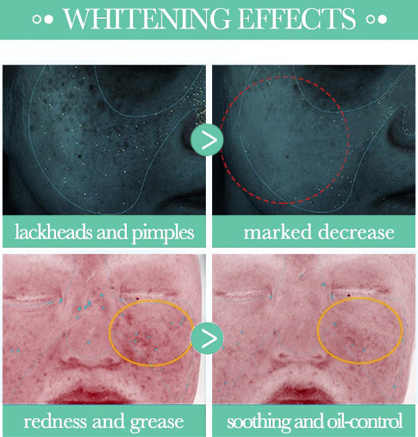 Final 3 Hours: 80% OFF🔥 Sebreght™ Mugwort Calming Clay Mask