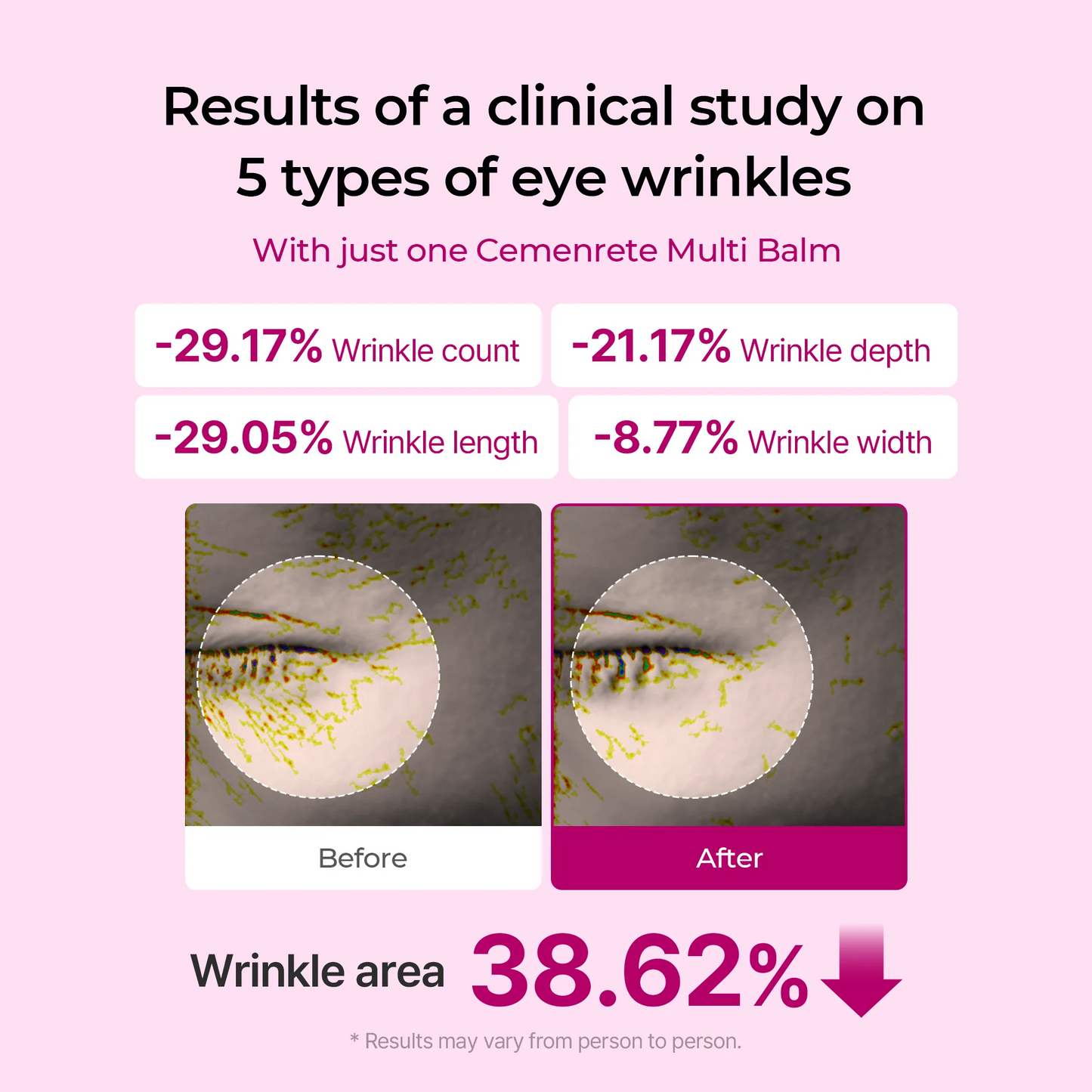 [Dr.Meloxin Official] Cemenrete Calcium Multi Balm | Anti-aging, Sagging, Wrinkles | Korean Cosmetics