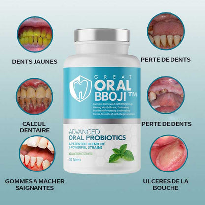 [Official Store]  🎁BBOJI™ Effervescent tooth regeneration tablets